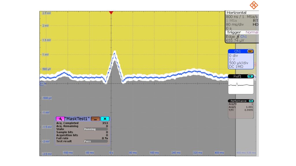 Captured ECG signal using 500 μV/div scale, HD mode and mask test.