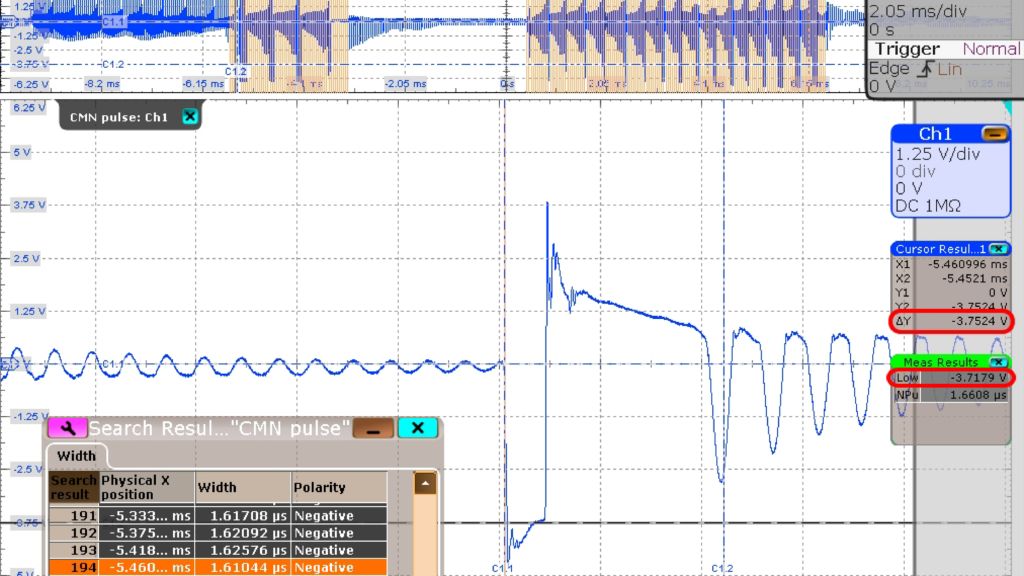 Fig. 3 : signal filtré du bruit de mode commun (CMN)