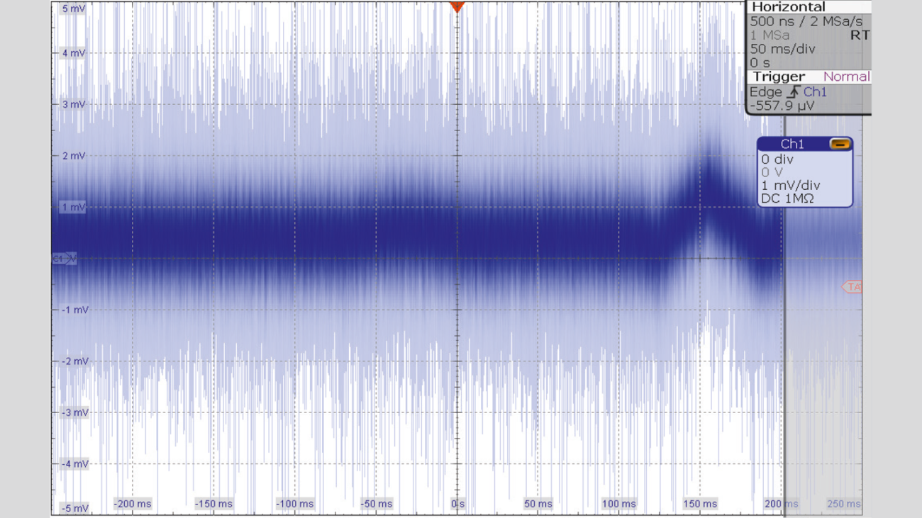Captured ECG signal after executing the Autoset. Captured ECG signal after executing the Autoset.