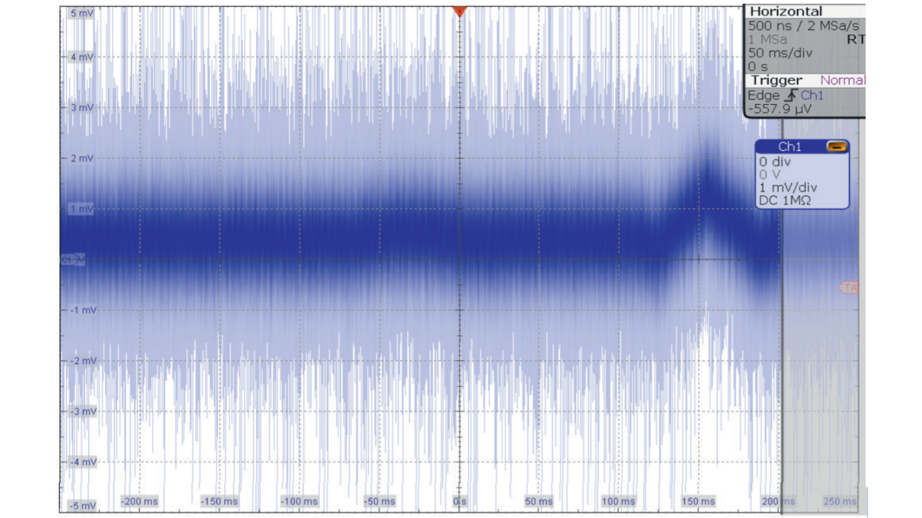 Captured ECG signal after executing the Autoset. Captured ECG signal after executing the Autoset.