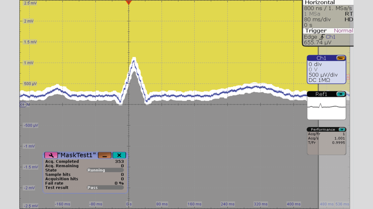 Captured ECG signal using 500 μV/div scale, HD mode and mask test. Captured ECG signal using 500 μV/div scale, HD mode and mask test.