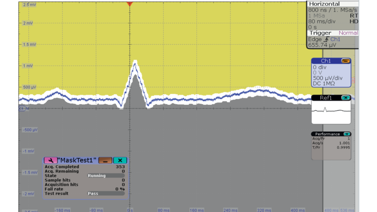 Captured ECG signal using 500 μV/div scale, HD mode and mask test. Captured ECG signal using 500 μV/div scale, HD mode and mask test.