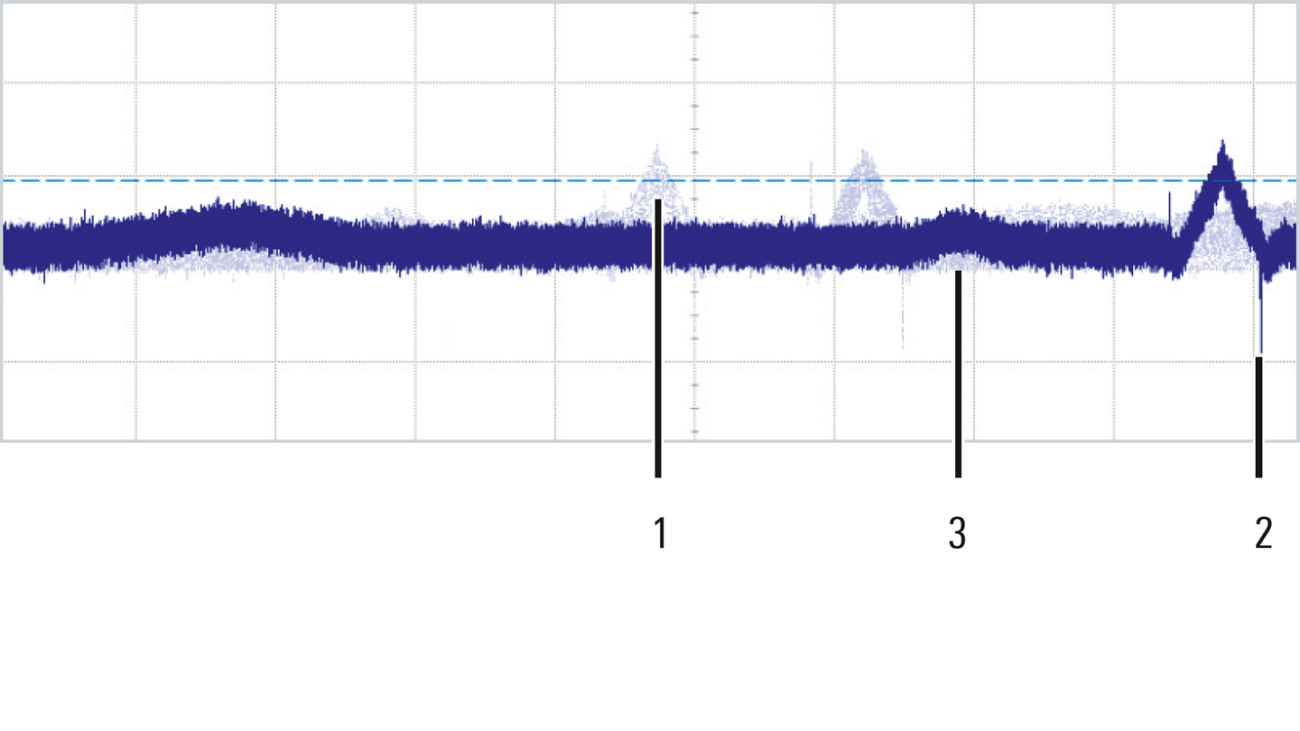 ECG signal ECG signal